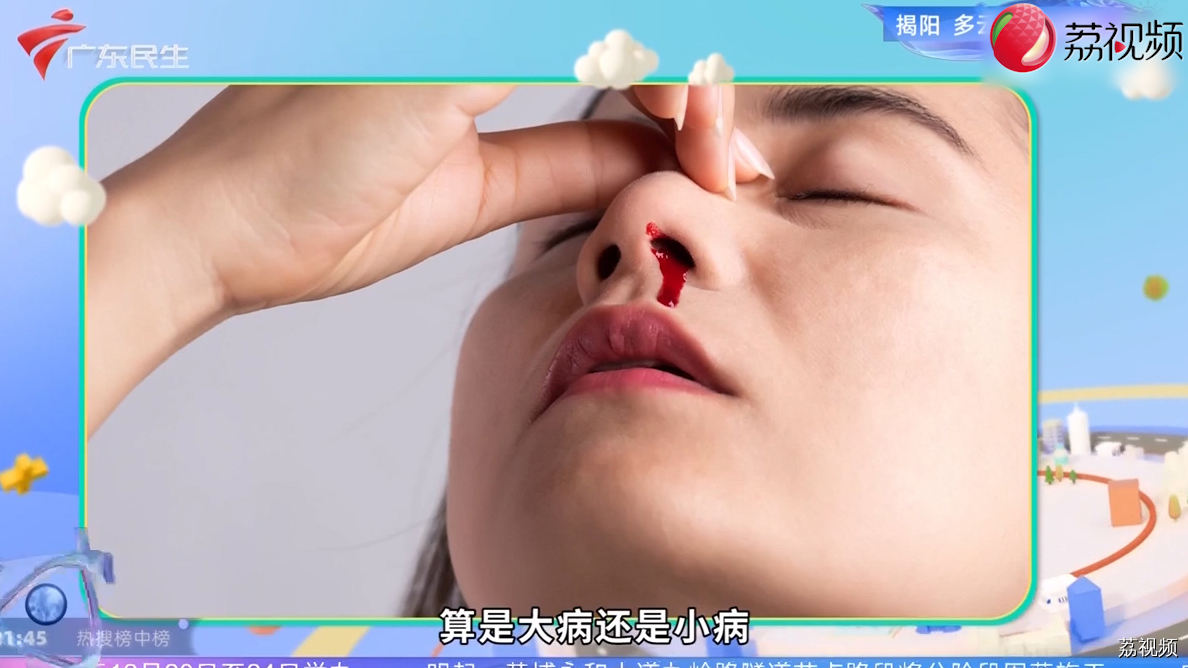 天气干燥流鼻血 医生教你止血妙招