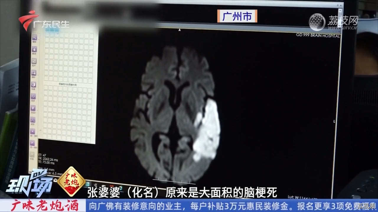 进入脑血管疾病高发期 患者需注意哪些事项