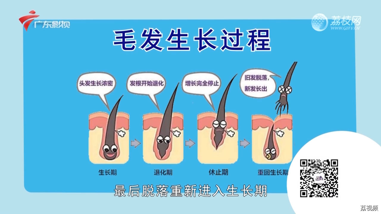 生姜能治疗斑秃？医生：小心对头皮造成二次损伤
