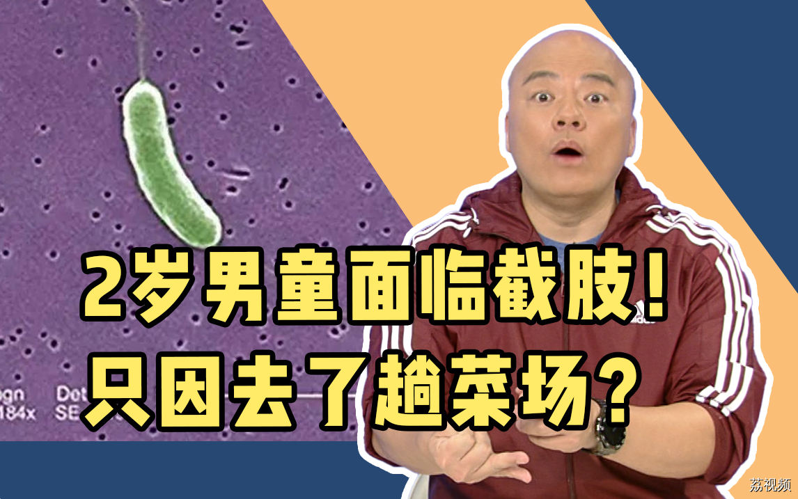 2岁男童住进ICU面临截肢！只因去了趟菜场？千万小心这个“致命”细菌！