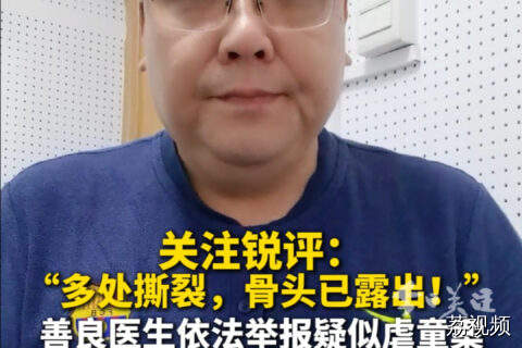 关注锐评：善良医生依法举报疑似虐童案必须点赞！