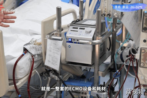 新闻中常见到的ECMO究竟是什么？