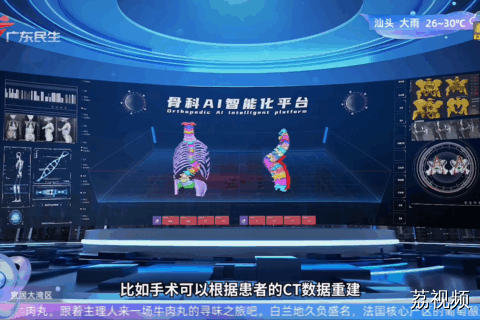 大模型如同“智能教练” 手术中实现精准导航