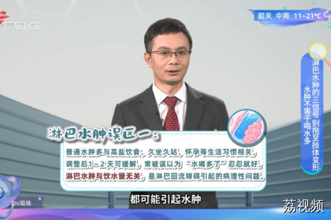 淋巴水肿的三信号别拖至肢体变形 水肿不等于喝水多