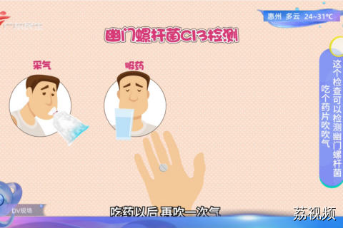 吃个药片吹吹气 这个检查可以检测幽门螺杆菌