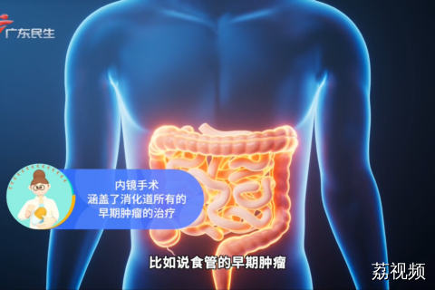 早期肿瘤用微创『拆弹』 科技守护『胃来』