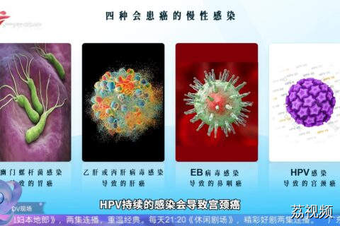 你忽视的这四种慢性感染可能养出癌细胞