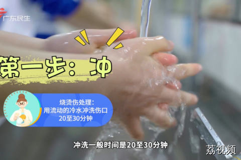 儿童烧烫伤 家庭急救手册