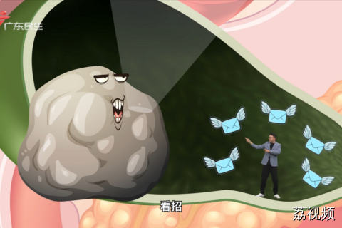 坚持五个“一” 有效预防胆囊结石！