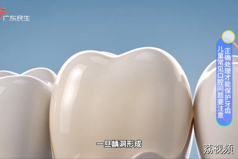 儿童常见口腔问题要注意 正确处理才能保护牙齿